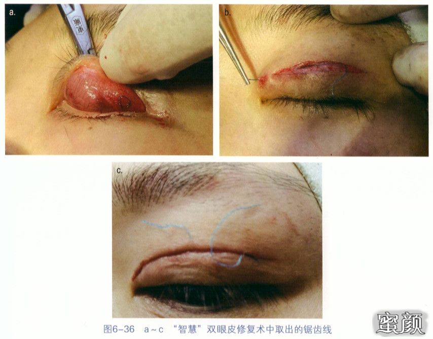 https://img.miyanlife.com/mnt/timg/200829/12561Ma6-3.jpg