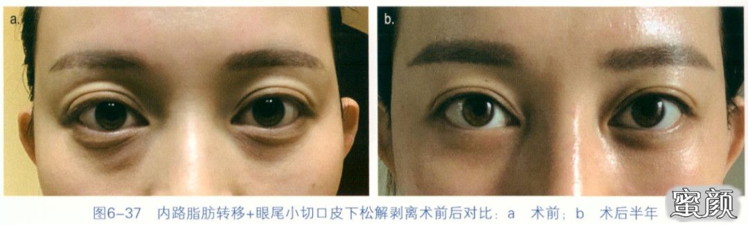 https://img.miyanlife.com/mnt/timg/200829/1256211B9-4.jpg