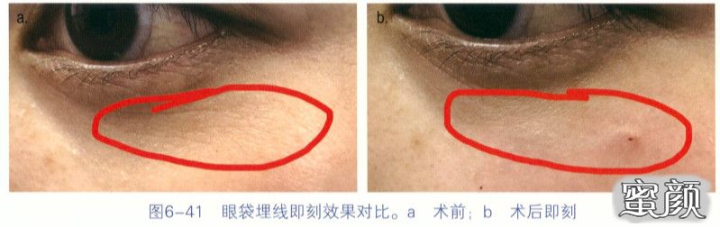 https://img.miyanlife.com/mnt/timg/200829/12563HJ4-8.jpg