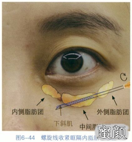 https://img.miyanlife.com/mnt/timg/200829/1256435a9-10.jpg