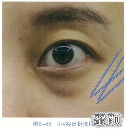 https://img.miyanlife.com/mnt/timg/200829/12564530P-11.jpg