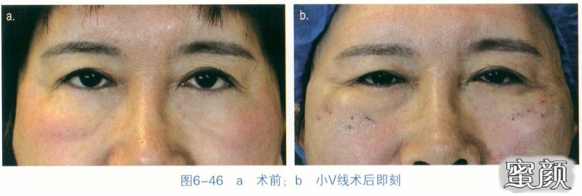 https://img.miyanlife.com/mnt/timg/200829/12564R034-12.jpg
