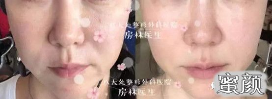 https://img.miyanlife.com/mnt/timg/200829/1259104310-2.jpg
