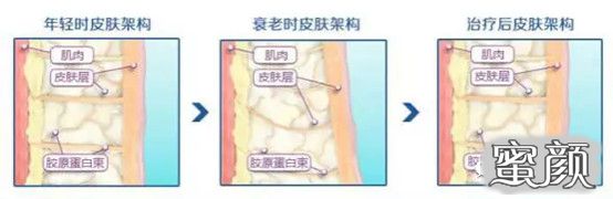 https://img.miyanlife.com/mnt/timg/200829/125Z913F-1.jpg