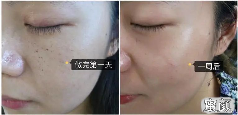 https://img.miyanlife.com/mnt/timg/200830/125911N20-2.jpg