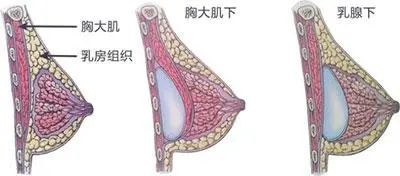 案例图片