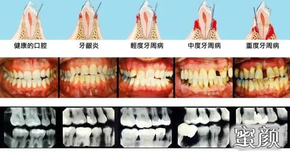 案例图片