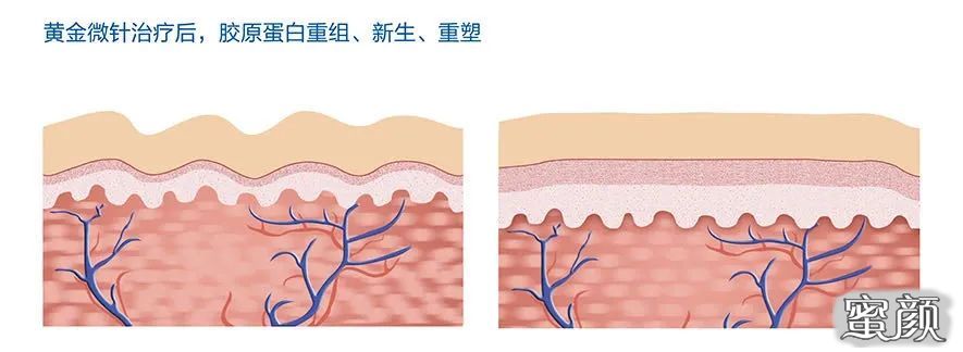 案例图片