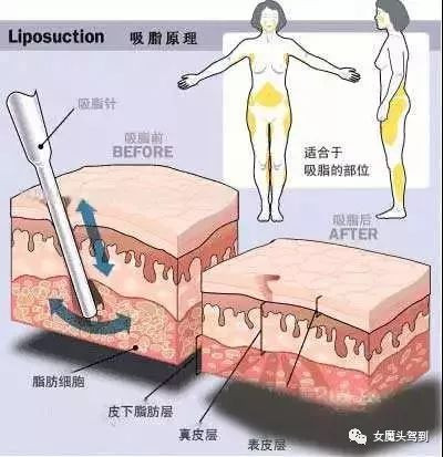 https://img.miyanlife.com/mnt/timg/201110/1F4192O8-2.jpg