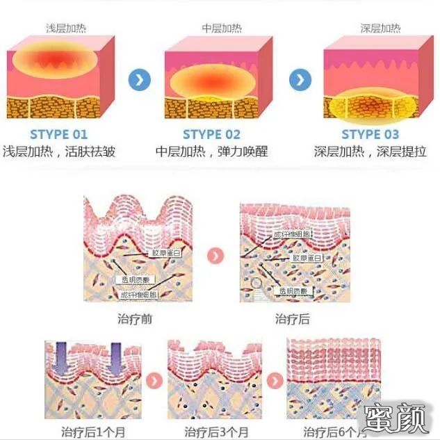 https://img.miyanlife.com/mnt/timg/201111/19202M4B-3.jpg