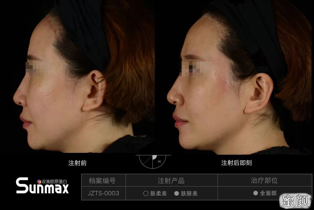 https://img.miyanlife.com/mnt/timg/201111/1PQ93259-13.jpg