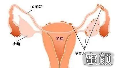 https://img.miyanlife.com/mnt/timg/201112/0AK054Z-3.jpg