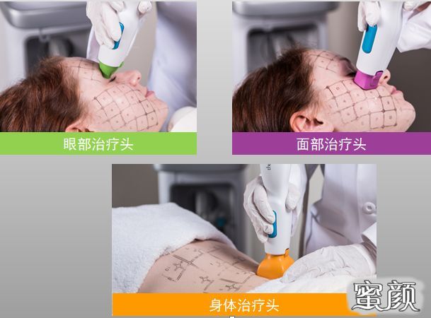 https://img.miyanlife.com/mnt/timg/201112/14010J537-2.jpg