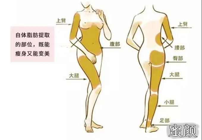 https://img.miyanlife.com/mnt/timg/201114/13394C208-5.jpg