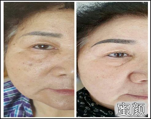 https://img.miyanlife.com/mnt/timg/201115/1AAM306-6.jpg