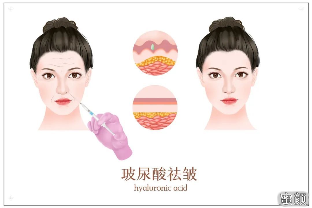 https://img.miyanlife.com/mnt/timg/201120/2320394633-0.jpg
