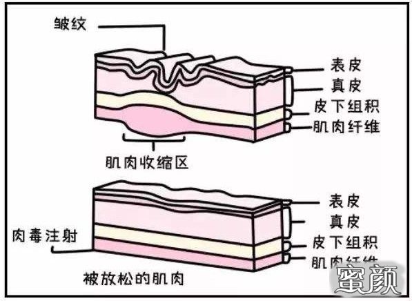 https://img.miyanlife.com/mnt/timg/201120/23204H415-2.jpg