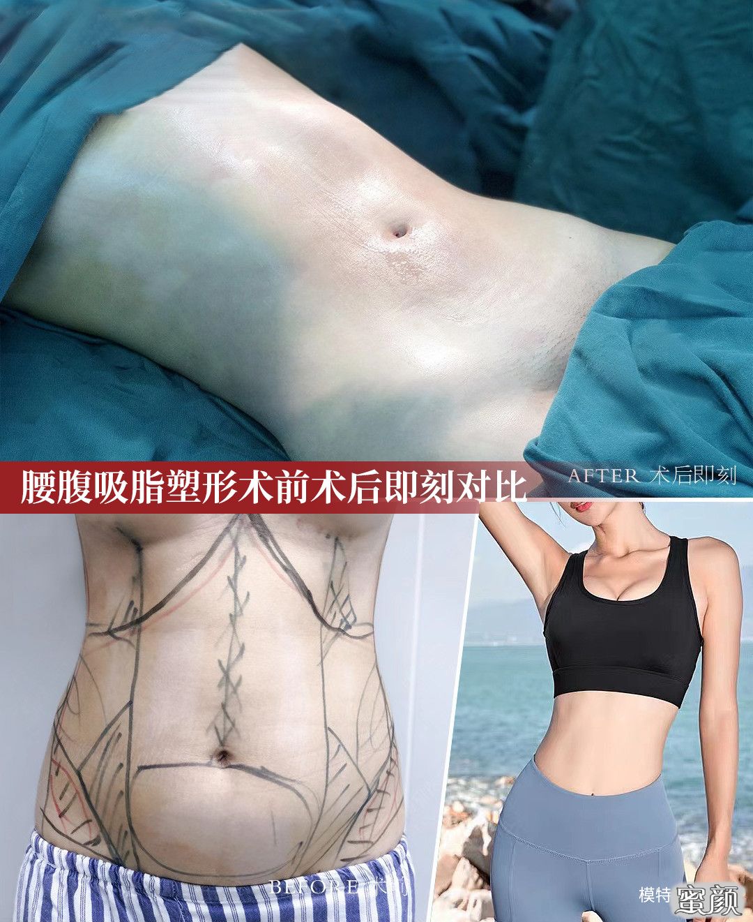 https://img.miyanlife.com/mnt/timg/201121/0F94125H-4.jpg