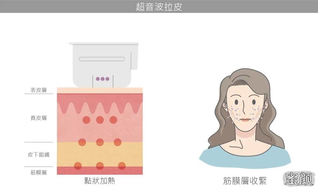 https://img.miyanlife.com/mnt/timg/201121/1409434F1-1.jpg