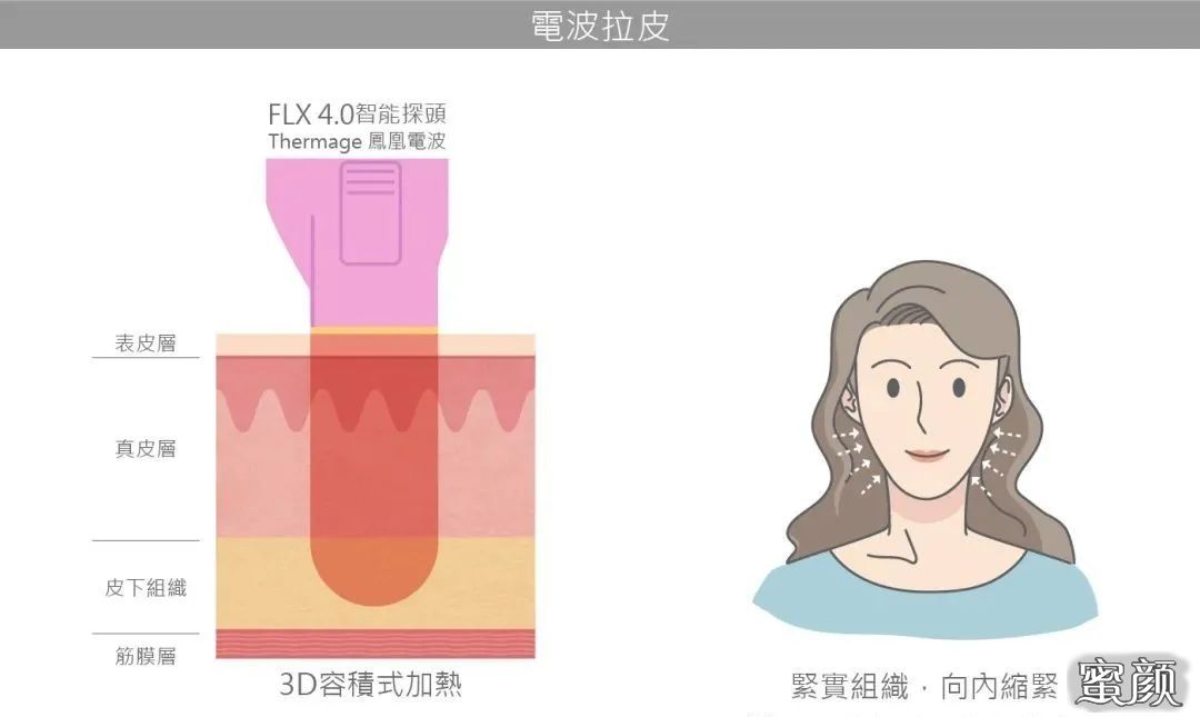 https://img.miyanlife.com/mnt/timg/201121/140943B30-3.jpg