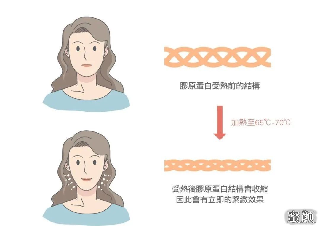 https://img.miyanlife.com/mnt/timg/201121/1409442W5-5.jpg