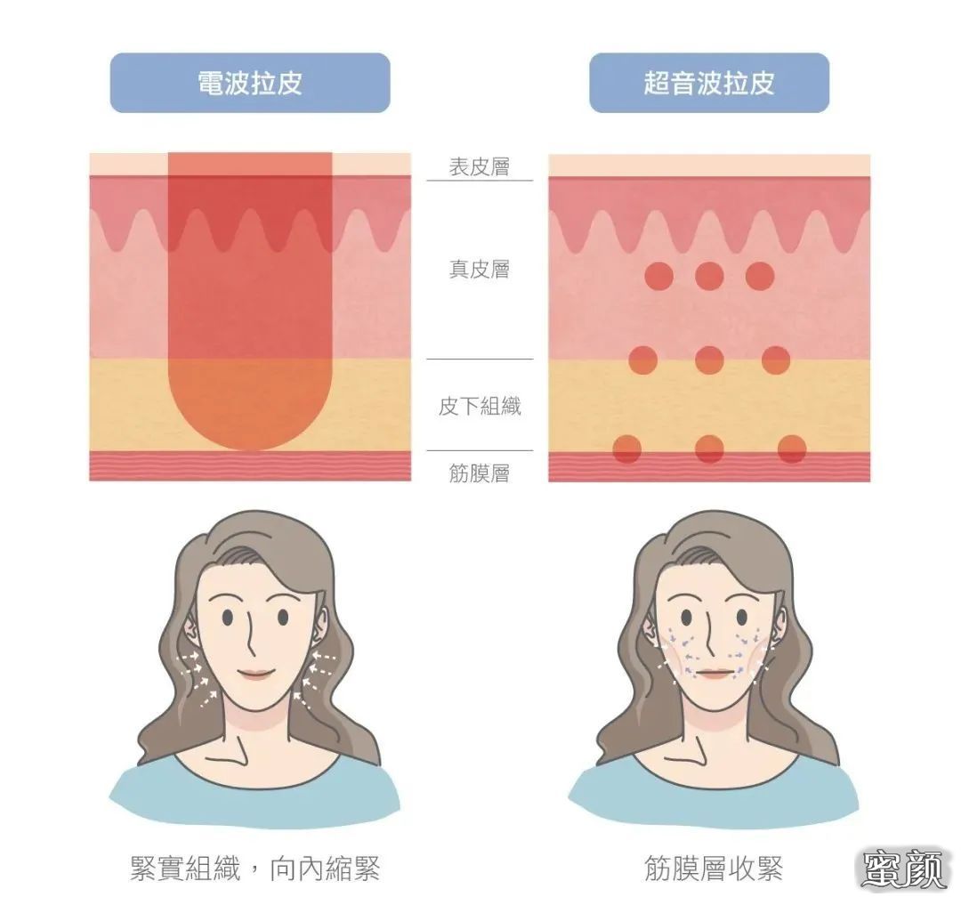 https://img.miyanlife.com/mnt/timg/201121/1409454C5-6.jpg