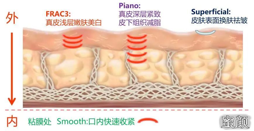 https://img.miyanlife.com/mnt/timg/201123/1326304L7-5.jpg