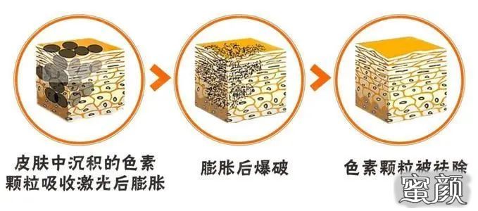 https://img.miyanlife.com/mnt/timg/201124/1AG05133-1.jpg