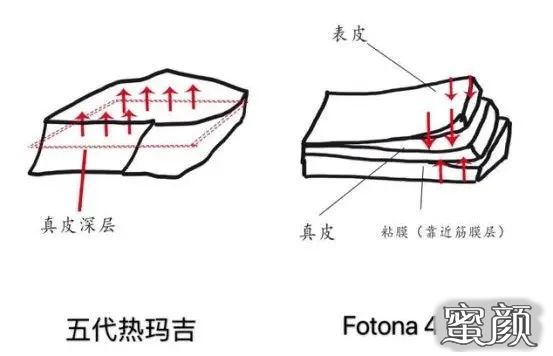 案例图片