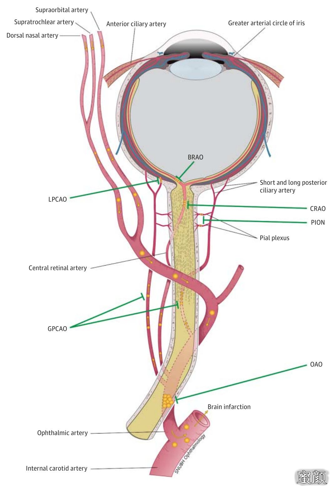 视网膜中央动脉解剖图片