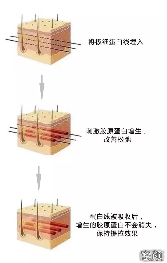 案例图片