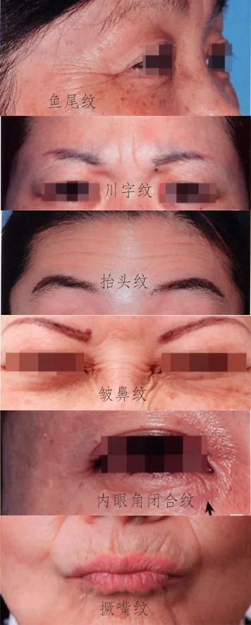 https://img.miyanlife.com/mnt/timg/201202/21462W150-1.jpg