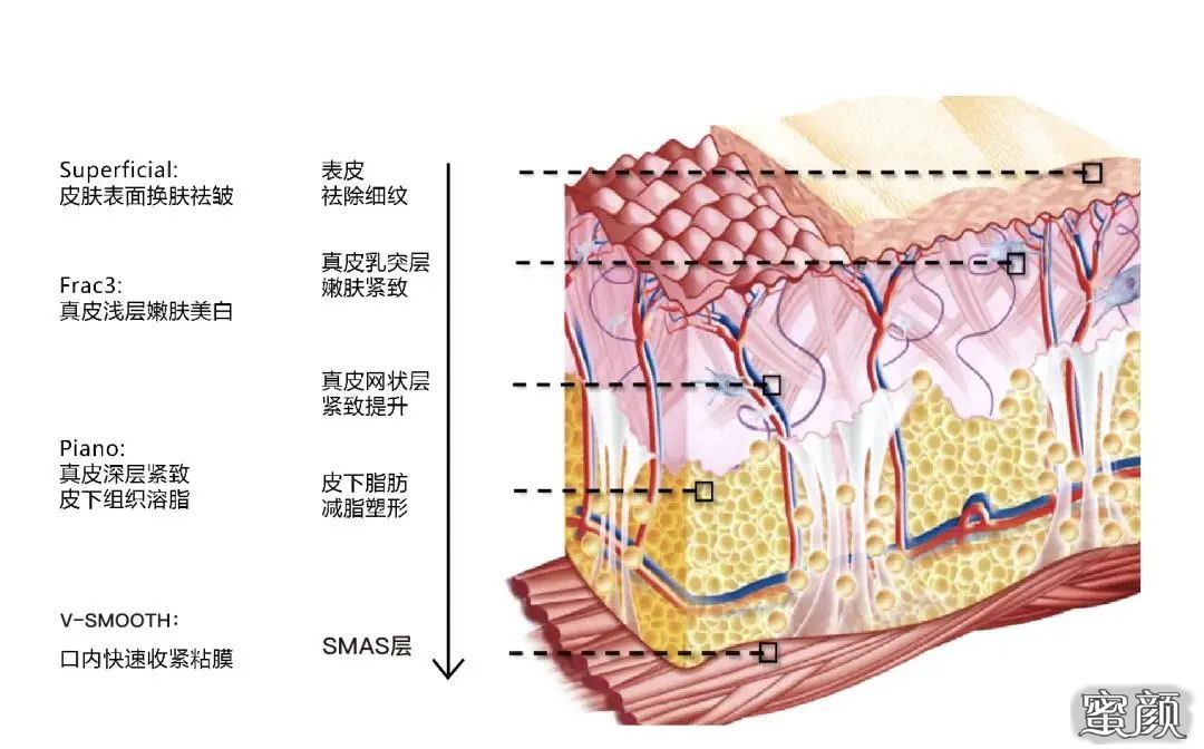 https://img.miyanlife.com/mnt/timg/201203/11450940R-0.jpg