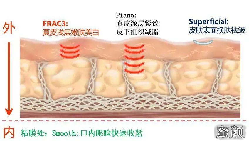https://img.miyanlife.com/mnt/timg/201203/121350M17-4.jpg