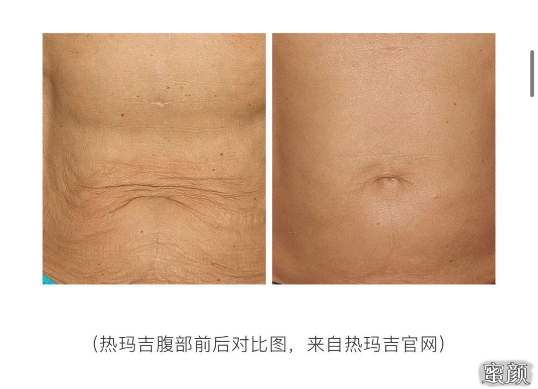 https://img.miyanlife.com/mnt/timg/201206/2149103324-9.jpg