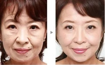 https://img.miyanlife.com/mnt/timg/201206/214910N92-8.jpg