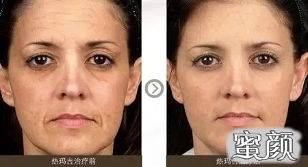https://img.miyanlife.com/mnt/timg/201206/214Z1H38-5.jpg