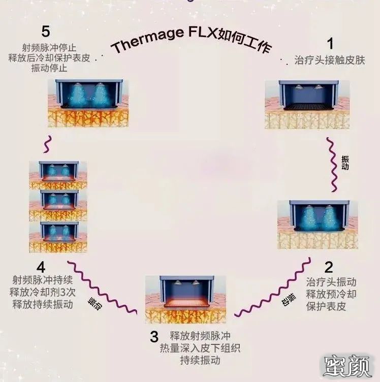 https://img.miyanlife.com/mnt/timg/201206/2314294102-2.jpg