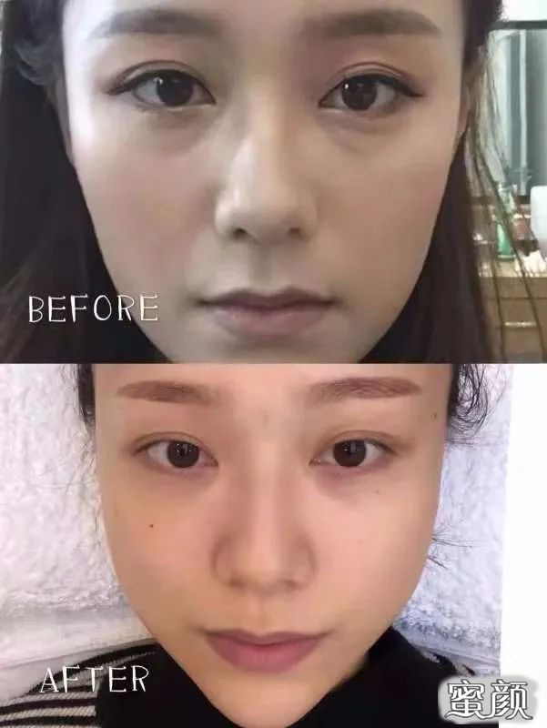 https://img.miyanlife.com/mnt/timg/201206/2315325b9-7.jpg