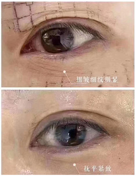 https://img.miyanlife.com/mnt/timg/201206/2315333440-8.jpg
