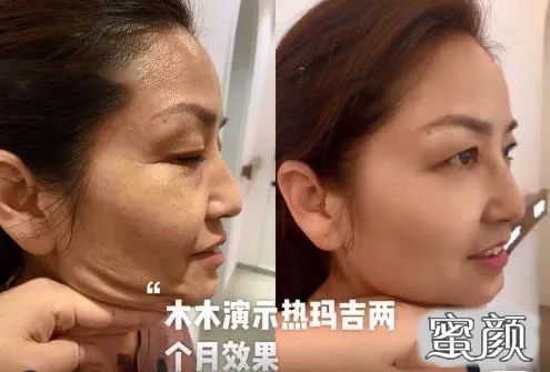 https://img.miyanlife.com/mnt/timg/201206/2315343K4-10.jpg