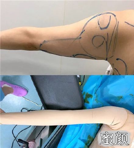 https://img.miyanlife.com/mnt/timg/201207/191T32T4-11.jpg