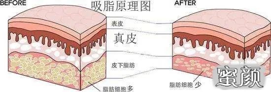 https://img.miyanlife.com/mnt/timg/201207/19261I154-2.jpg