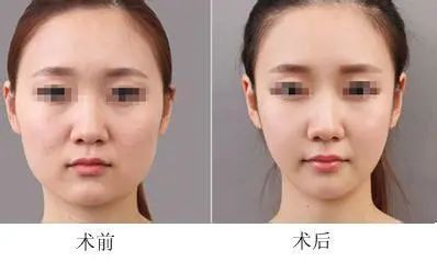 https://img.miyanlife.com/mnt/timg/201207/1RG944b-1.jpg