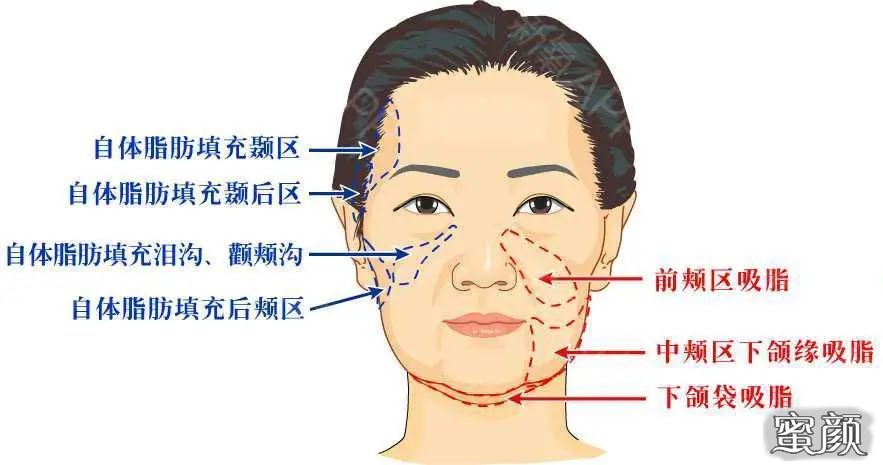 https://img.miyanlife.com/mnt/timg/201207/1RH141M-2.jpg