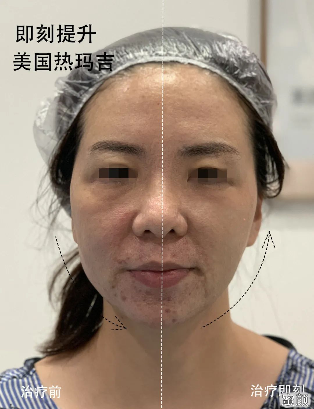 https://img.miyanlife.com/mnt/timg/201207/1UT913E-5.jpg