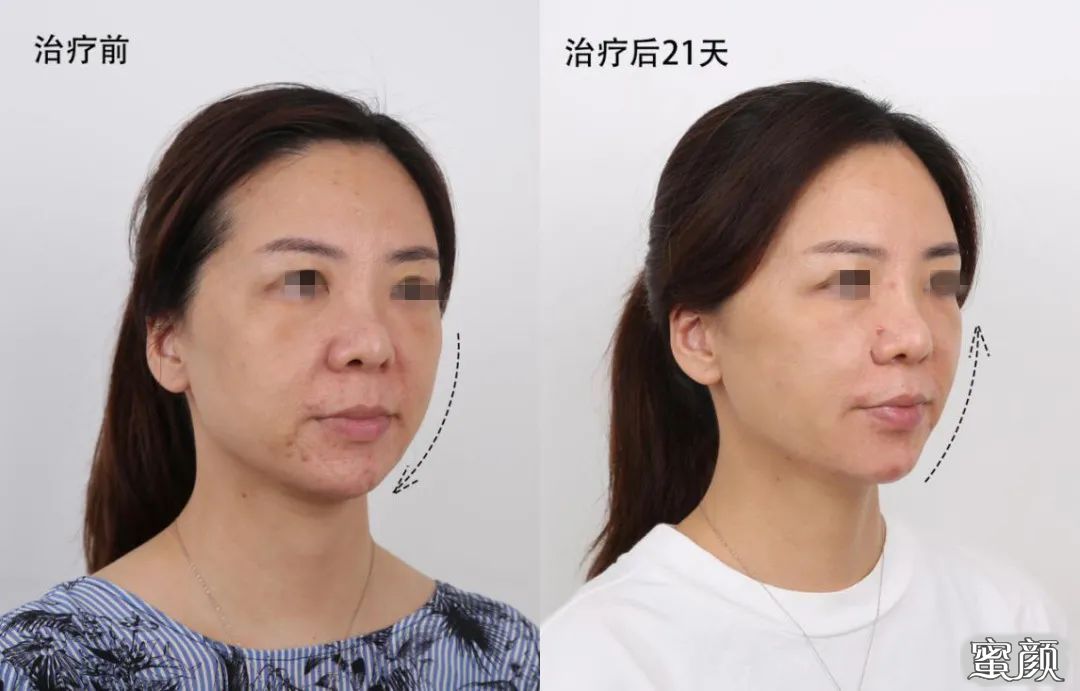 https://img.miyanlife.com/mnt/timg/201207/1UU04G0-6.jpg
