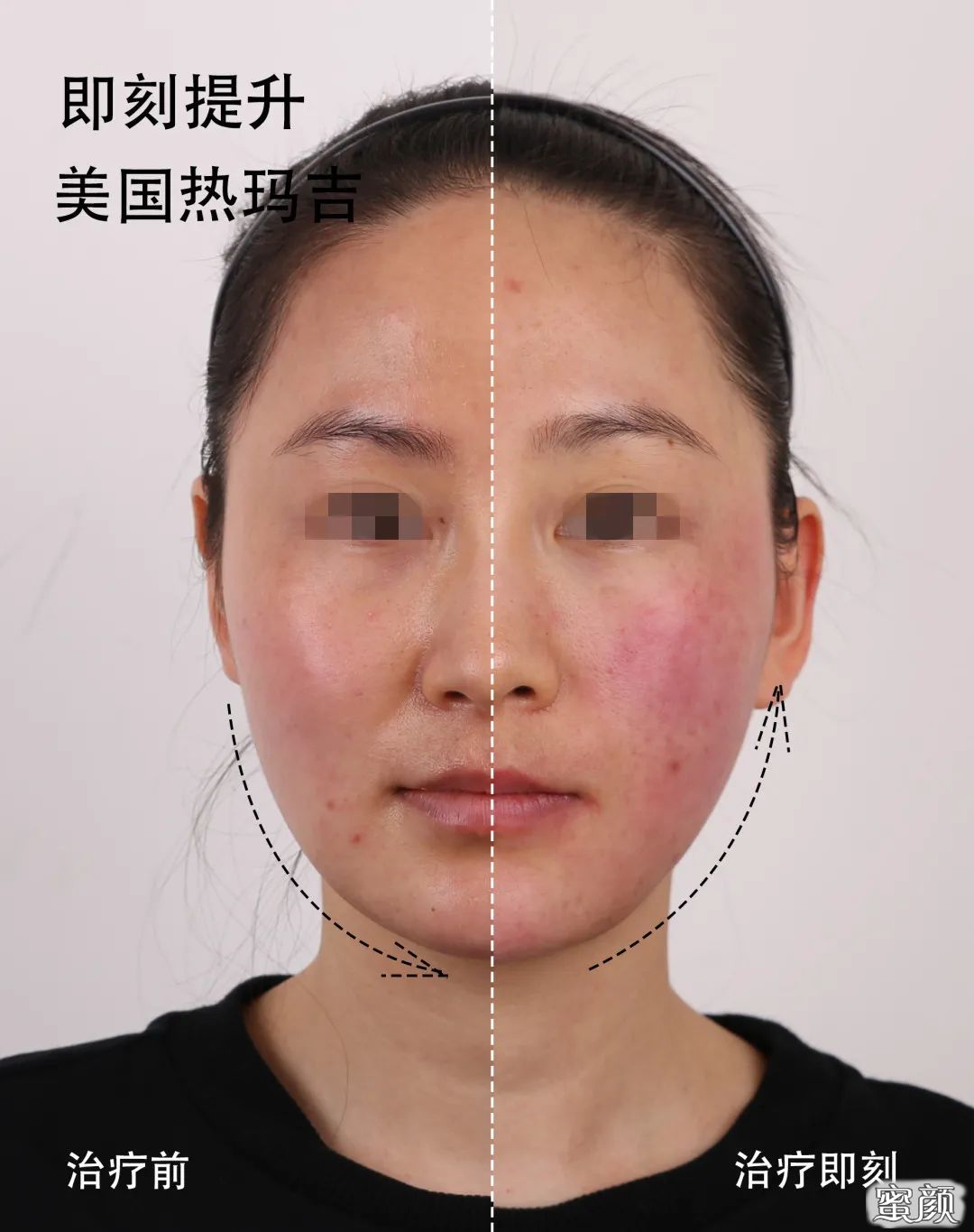 https://img.miyanlife.com/mnt/timg/201207/1UU1F01-7.jpg