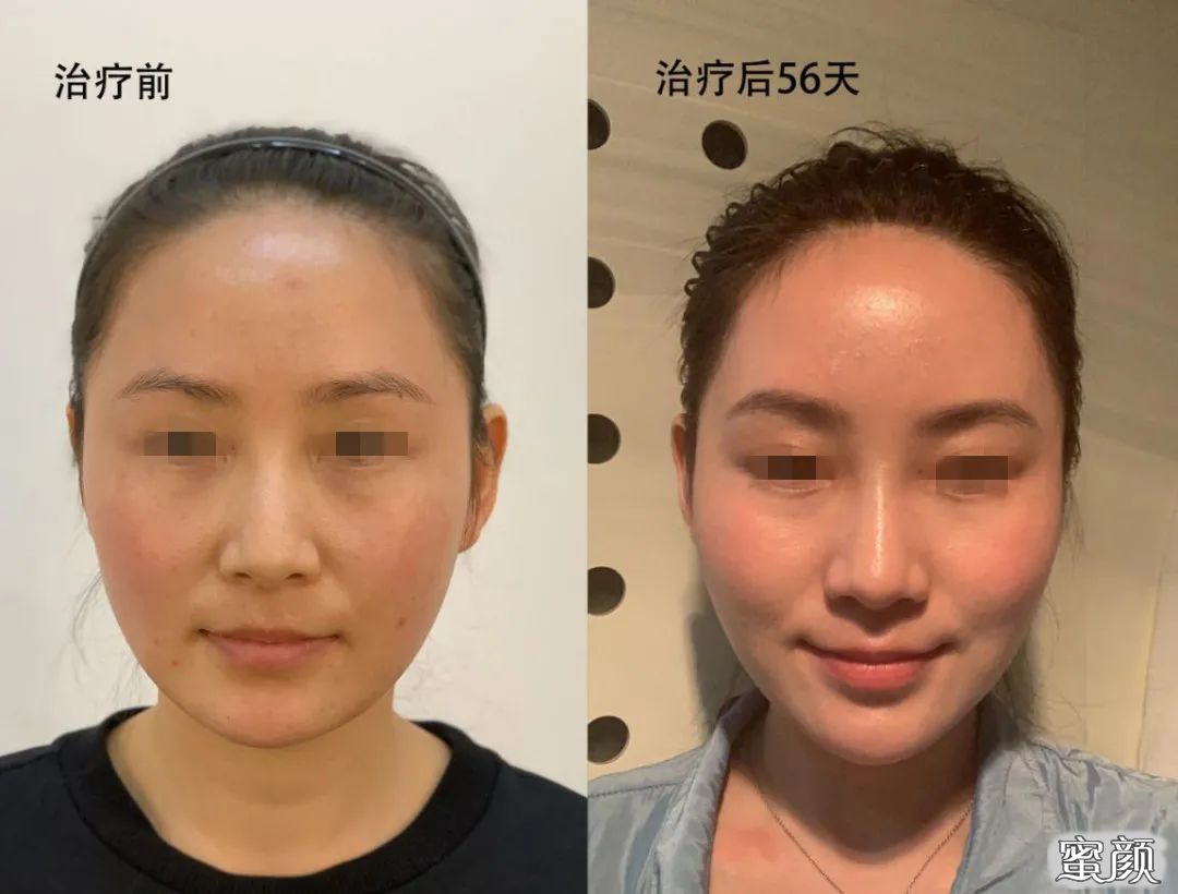 https://img.miyanlife.com/mnt/timg/201207/1UU260T-8.jpg
