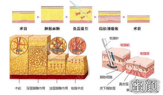 https://img.miyanlife.com/mnt/timg/201208/0I15Cb3-5.jpg